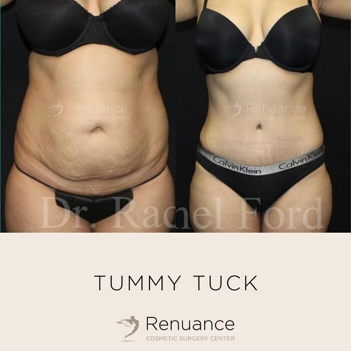 Images Renuance Cosmetic Surgery and MedSpa