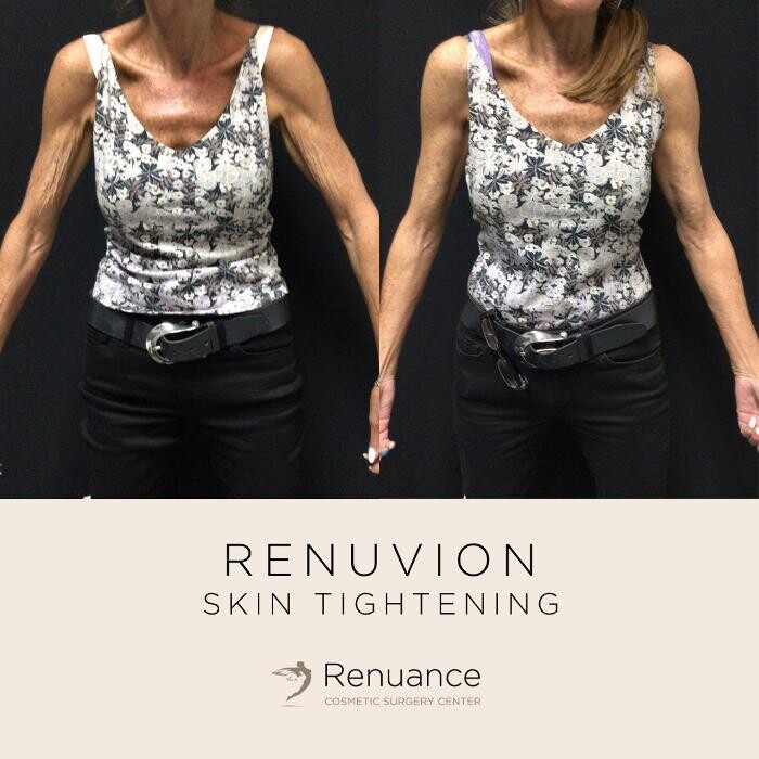 Images Renuance Cosmetic Surgery and MedSpa