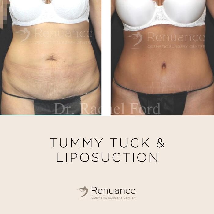 Images Renuance Cosmetic Surgery and MedSpa