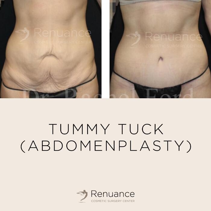 Images Renuance Cosmetic Surgery and MedSpa