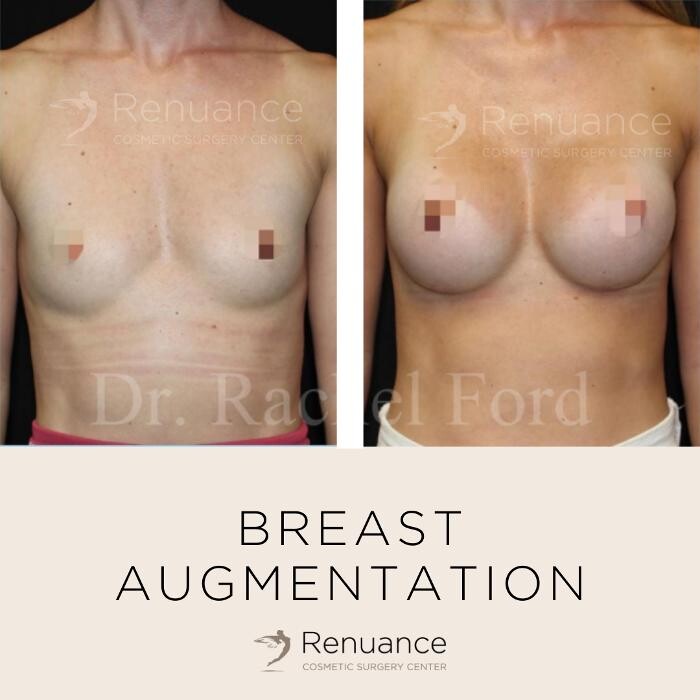 Images Renuance Cosmetic Surgery and MedSpa