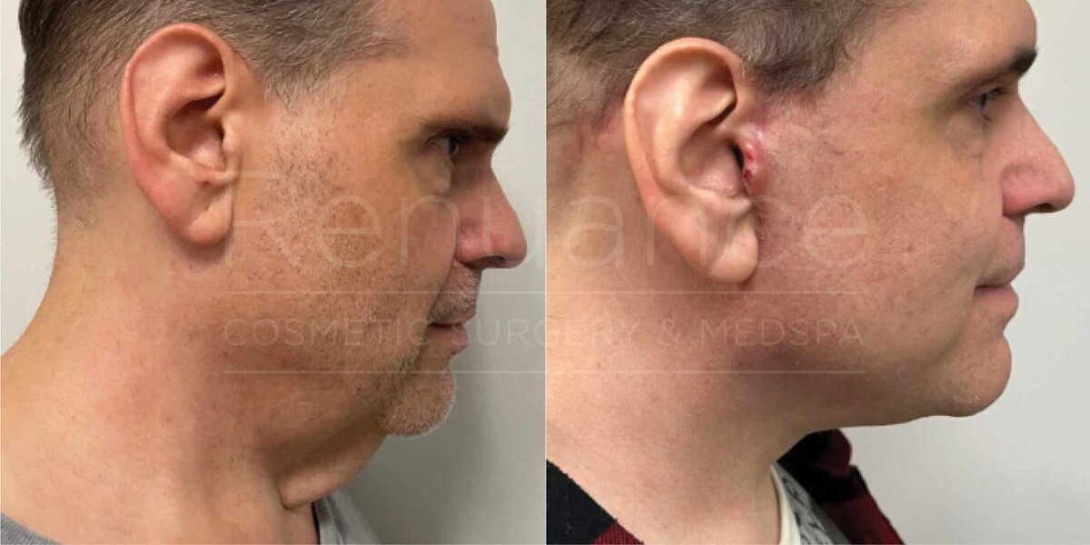 Images Renuance Cosmetic Surgery and MedSpa