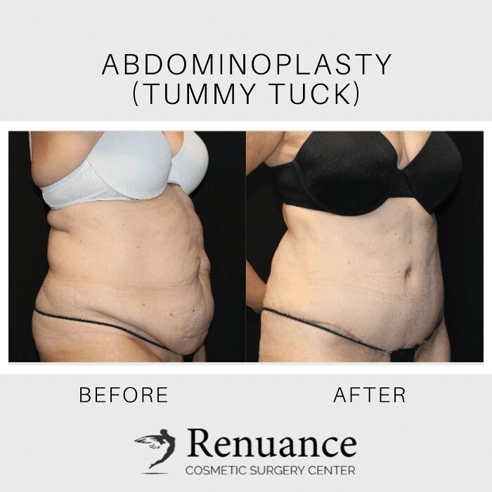 Images Renuance Cosmetic Surgery and MedSpa