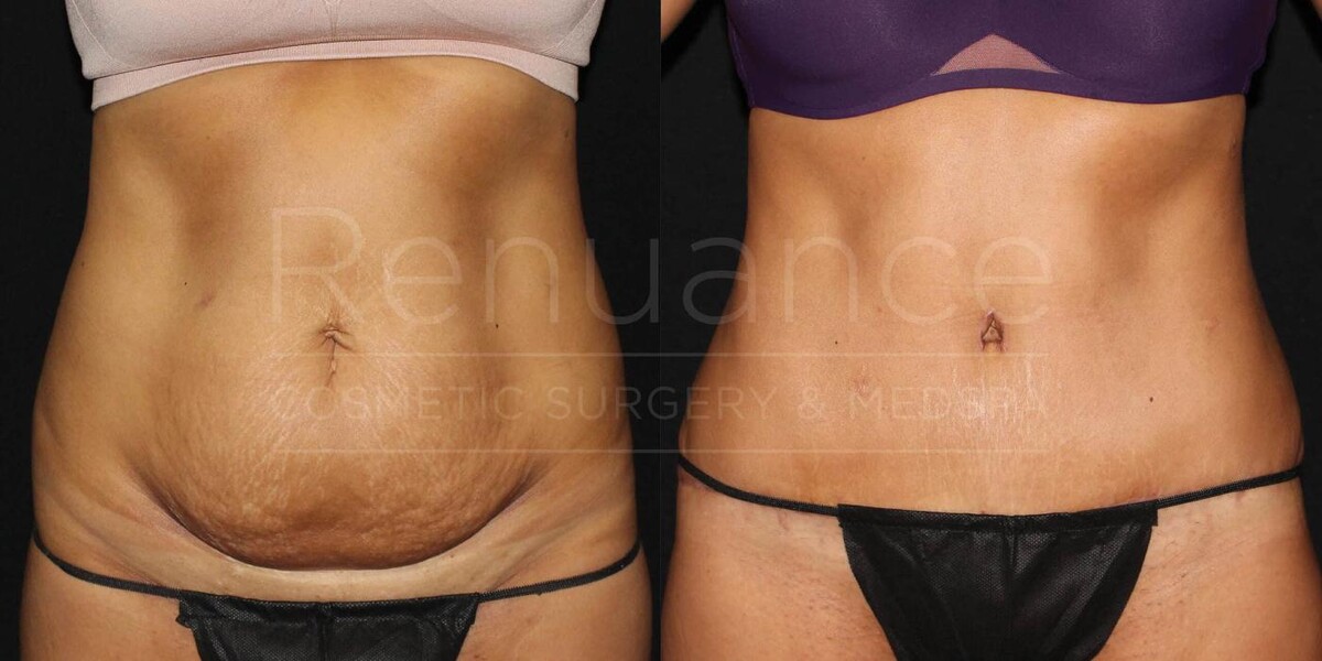 Images Renuance Cosmetic Surgery and MedSpa