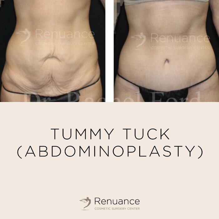 Images Renuance Cosmetic Surgery and MedSpa