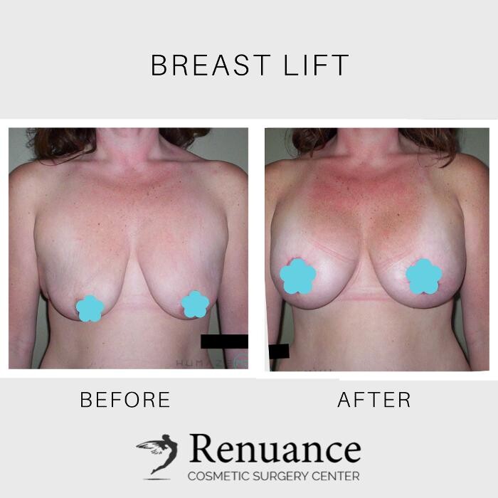 Images Renuance Cosmetic Surgery and MedSpa