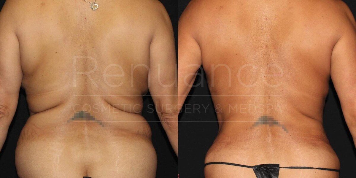 Images Renuance Cosmetic Surgery and MedSpa