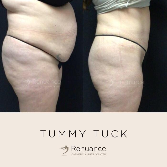 Images Renuance Cosmetic Surgery and MedSpa