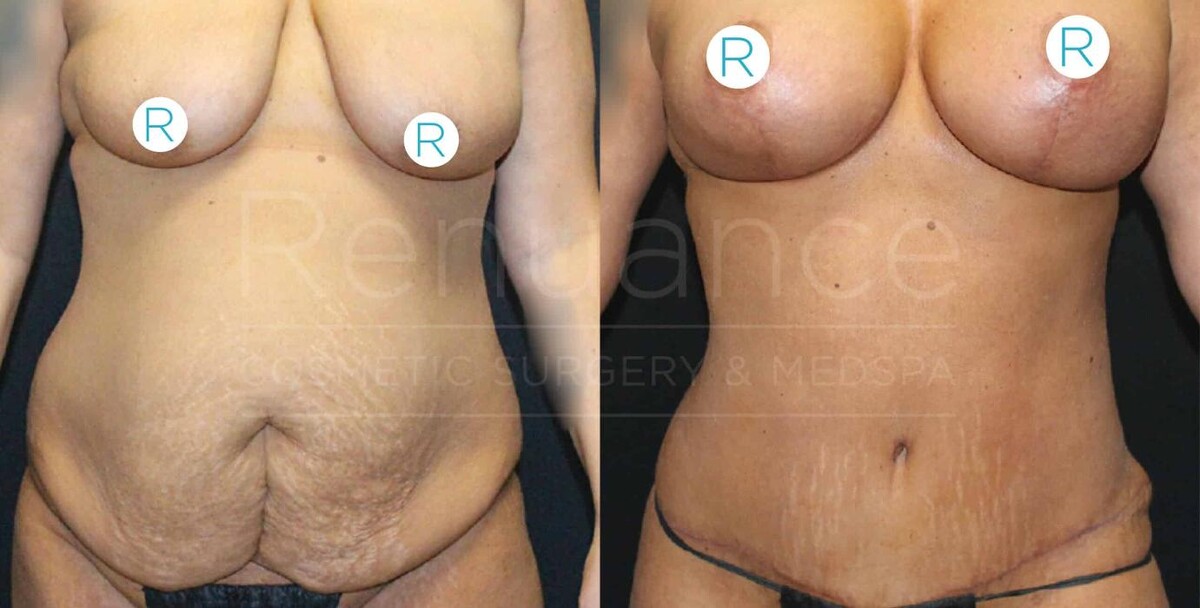Images Renuance Cosmetic Surgery and MedSpa
