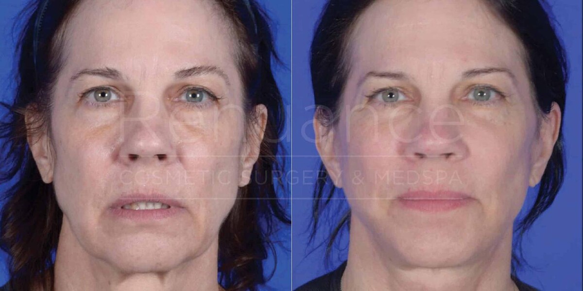 Images Renuance Cosmetic Surgery and MedSpa