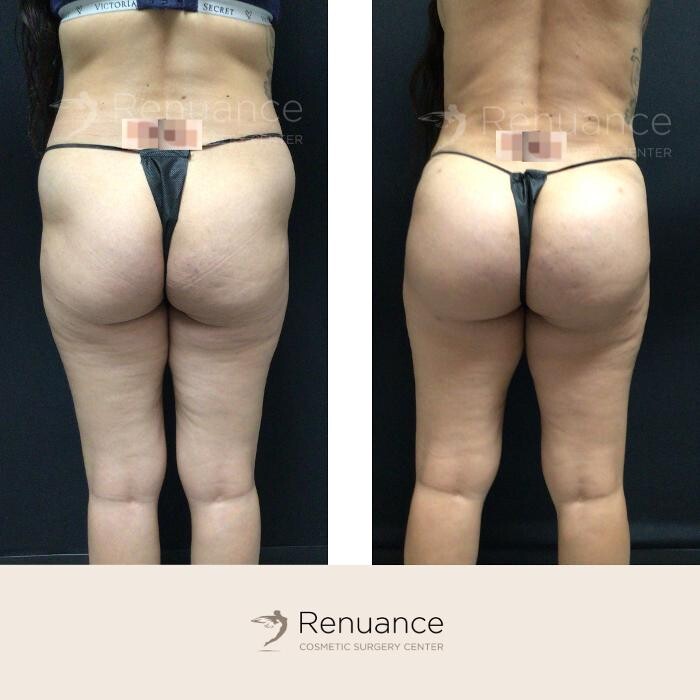 Images Renuance Cosmetic Surgery and MedSpa