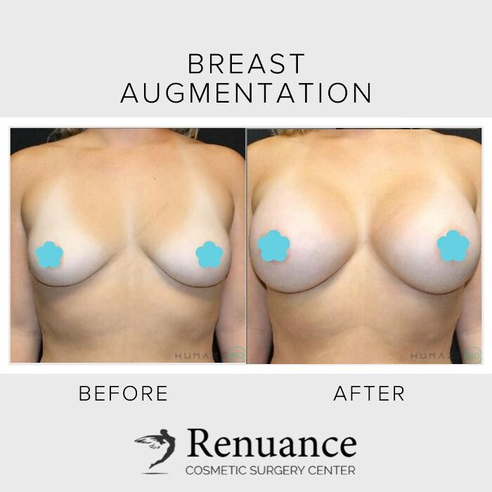 Images Renuance Cosmetic Surgery and MedSpa