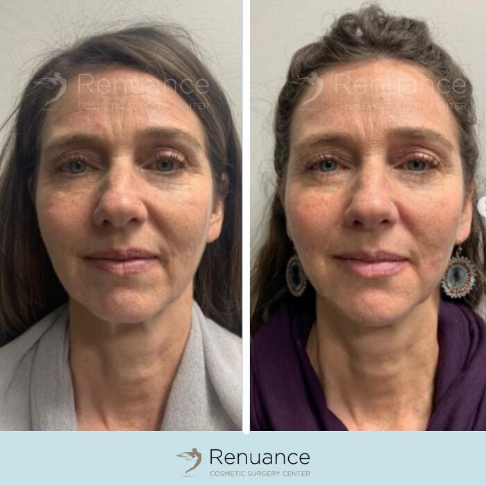 Images Renuance Cosmetic Surgery and MedSpa