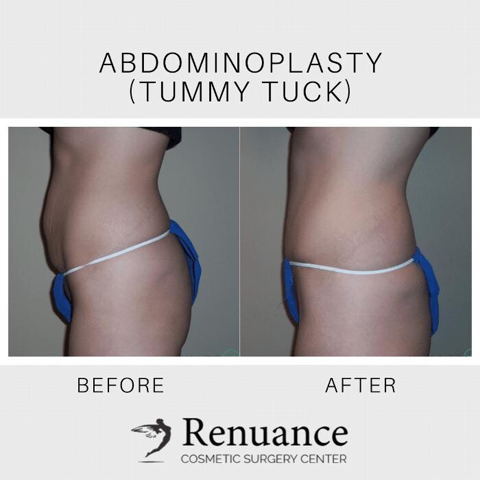 Images Renuance Cosmetic Surgery and MedSpa