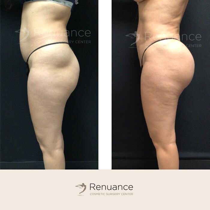 Images Renuance Cosmetic Surgery and MedSpa