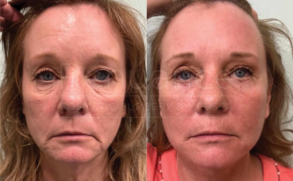 Images Renuance Cosmetic Surgery and MedSpa