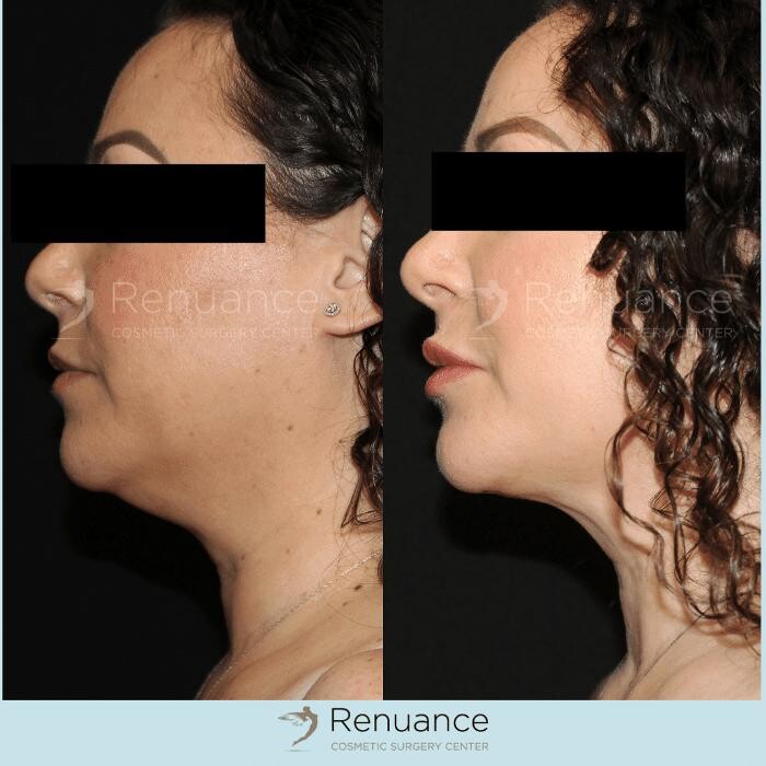 Images Renuance Cosmetic Surgery and MedSpa