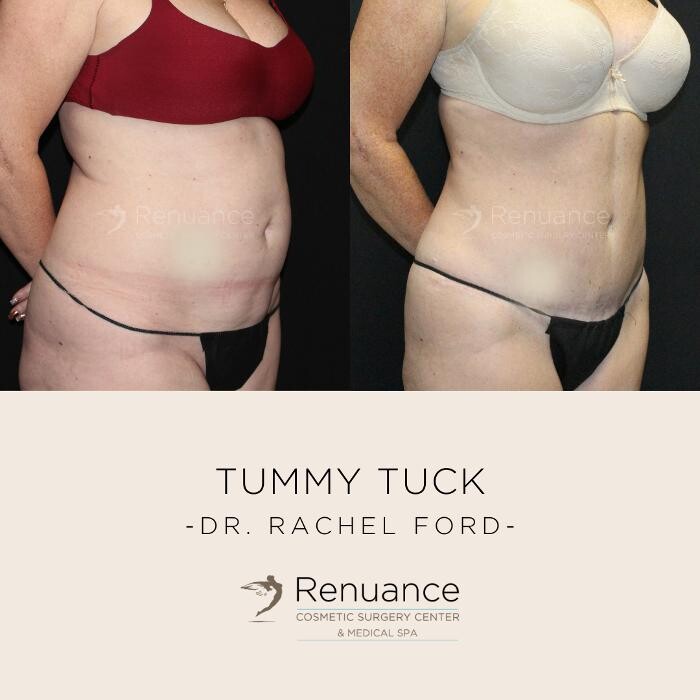 Images Renuance Cosmetic Surgery and MedSpa