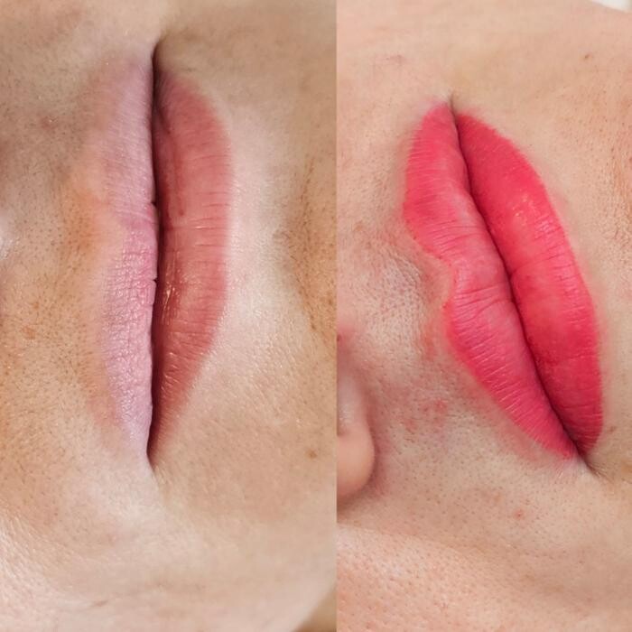 Images Darling Esthetics