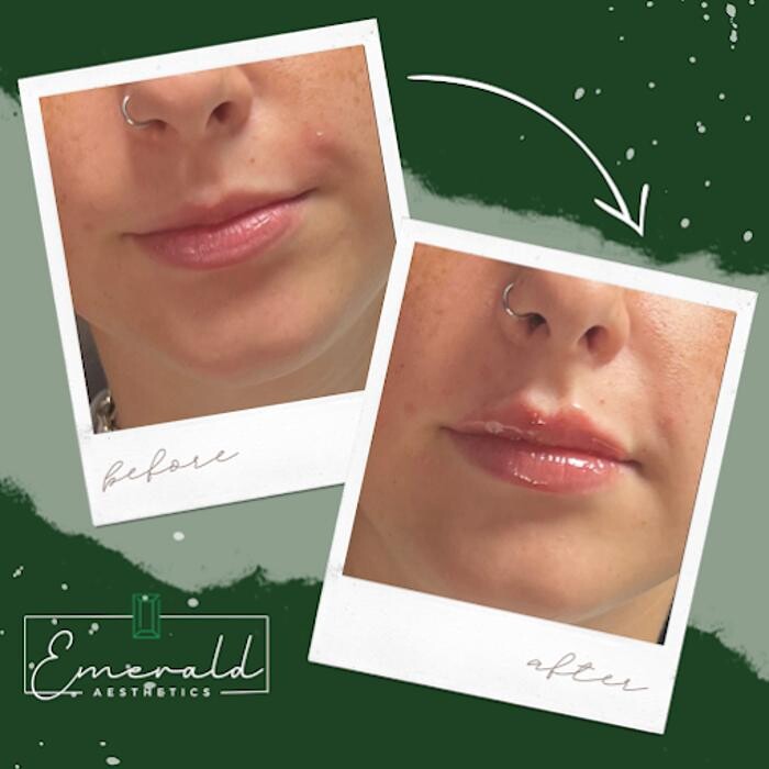 Images Emerald Aesthetics Medical Spa