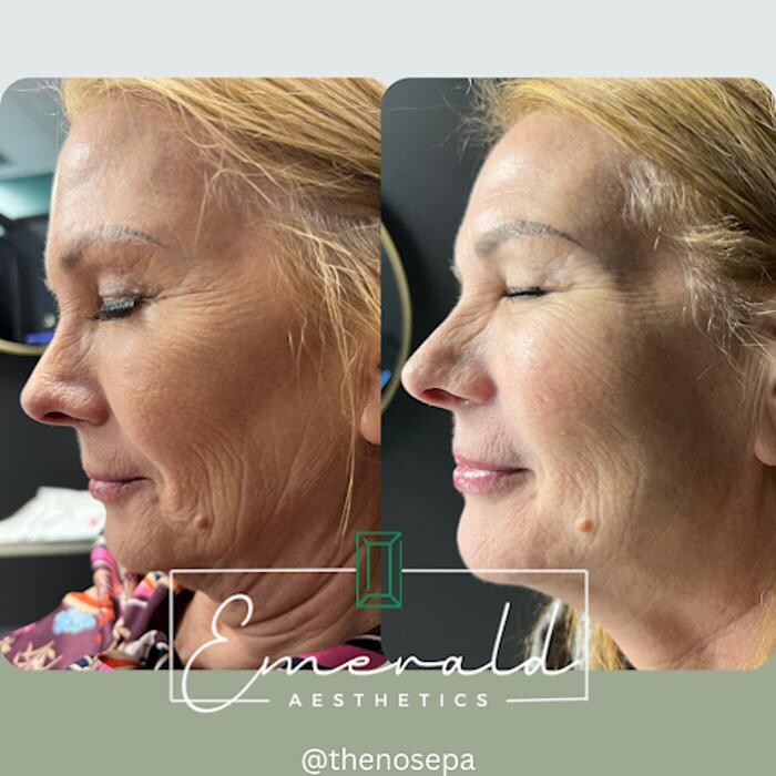 Images Emerald Aesthetics Medical Spa