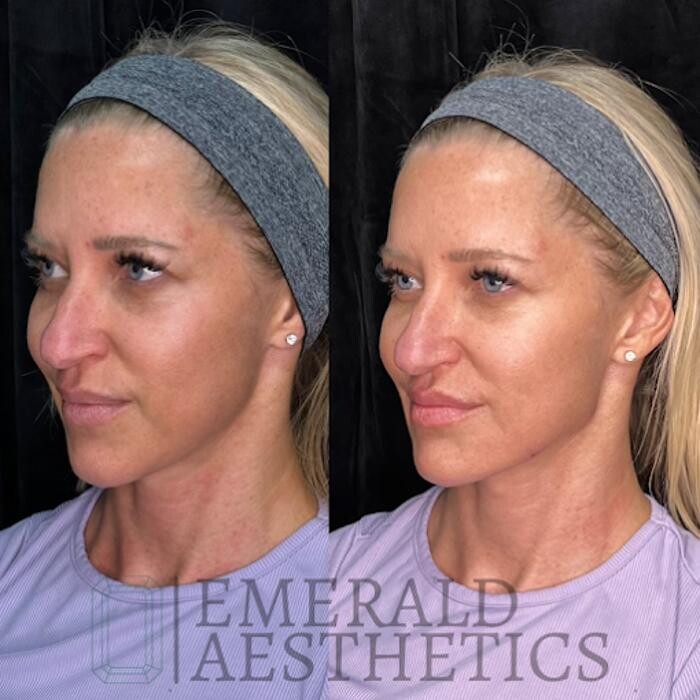 Images Emerald Aesthetics Medical Spa