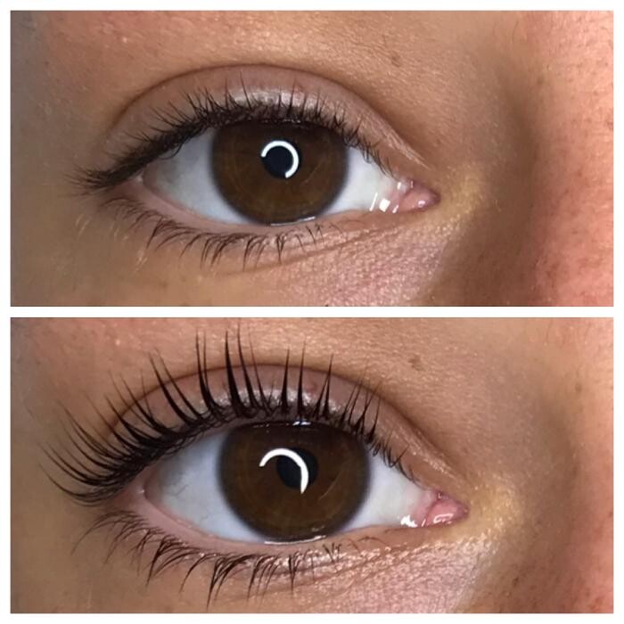 Images SKN Shack | Facials, Botox, Microneedling & Weight Loss in Nashville