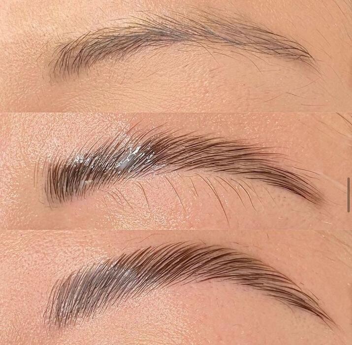 Images SKN Shack | Facials, Botox, Microneedling & Weight Loss in Nashville