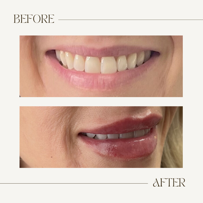 Images SKN Shack | Facials, Botox, Microneedling & Weight Loss in Nashville