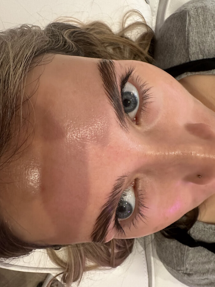 Images SKN Shack | Facials, Botox, Microneedling & Weight Loss in Nashville