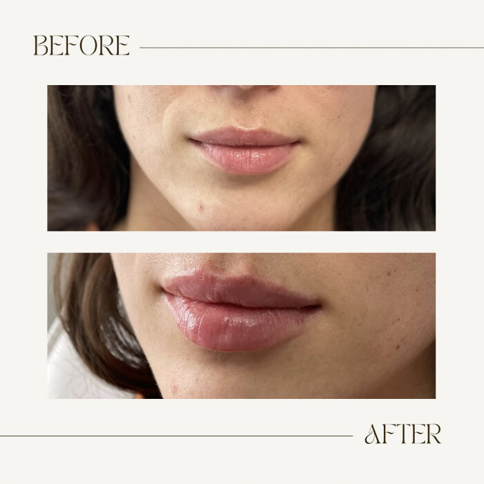 Images SKN Shack | Facials, Botox, Microneedling & Weight Loss in Nashville