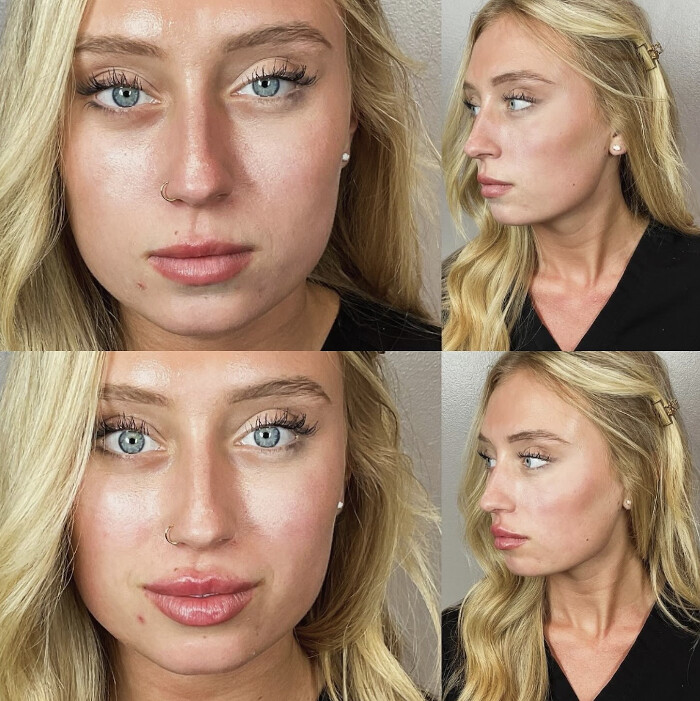 Images SKN Shack | Facials, Botox, Microneedling & Weight Loss in Nashville