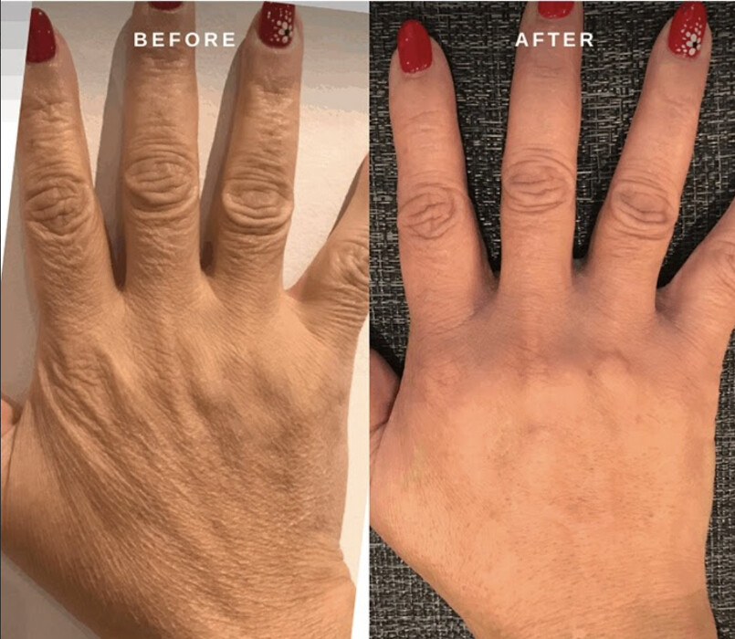 Images SKN Shack | Facials, Botox, Microneedling & Weight Loss in Nashville