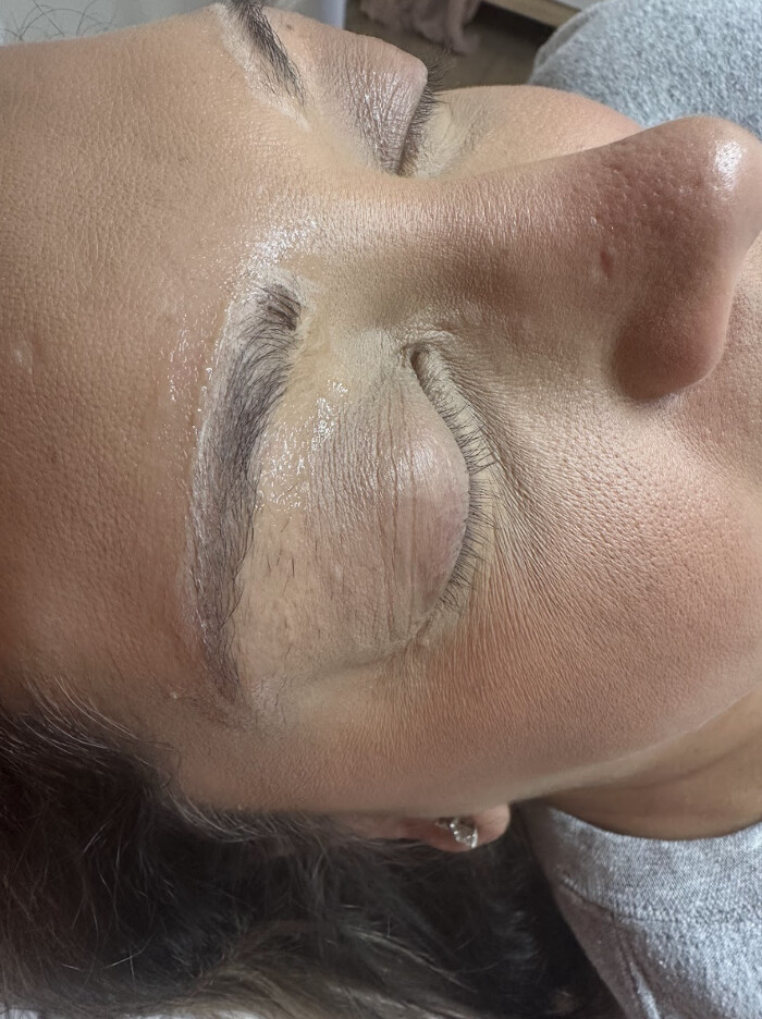 Images SKN Shack | Facials, Botox, Microneedling & Weight Loss in Nashville