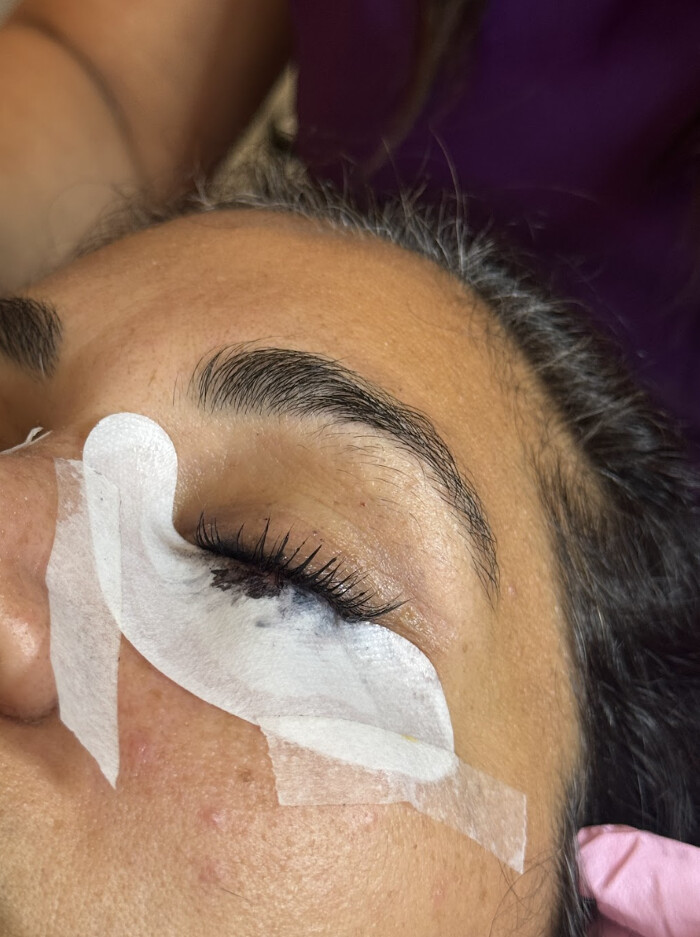 Images SKN Shack | Facials, Botox, Microneedling & Weight Loss in Nashville