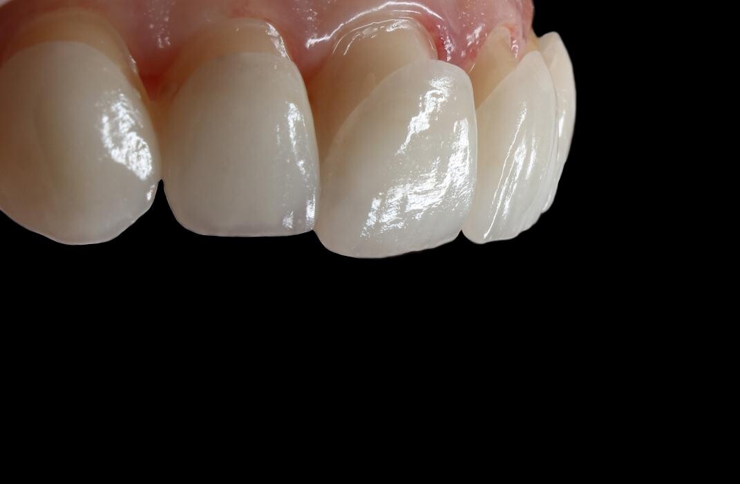 Images Downey Dental Solutions