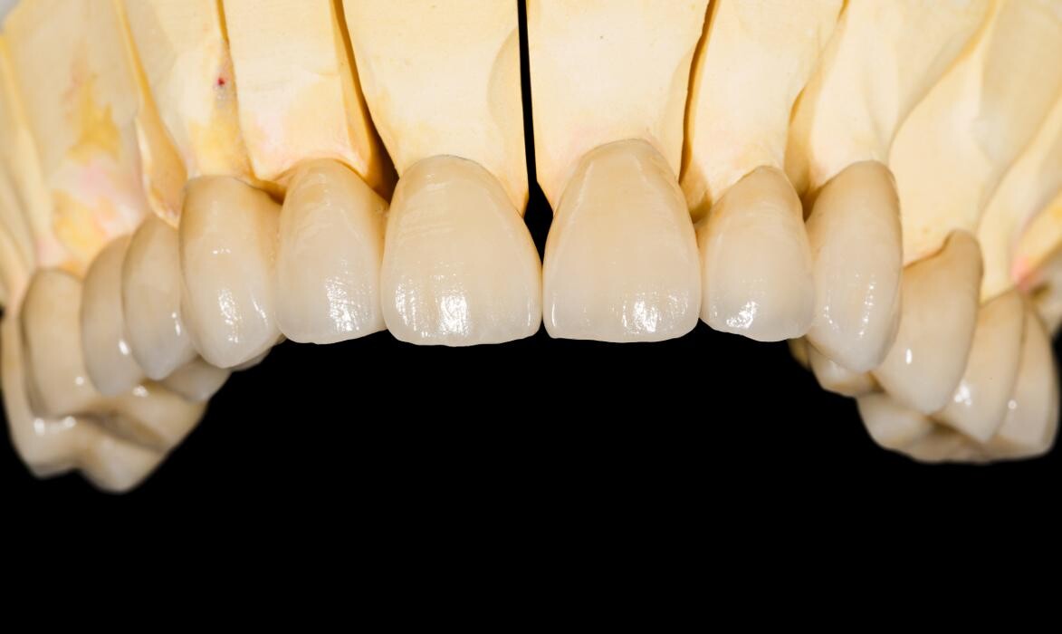 Images Downey Dental Solutions