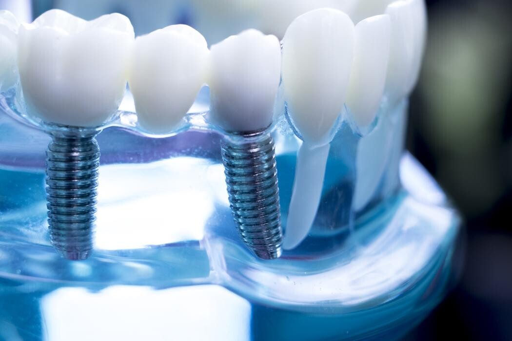 Images Downey Dental Solutions