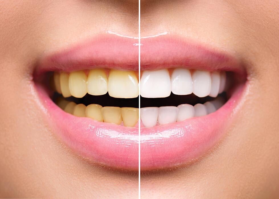 Images Downey Dental Solutions