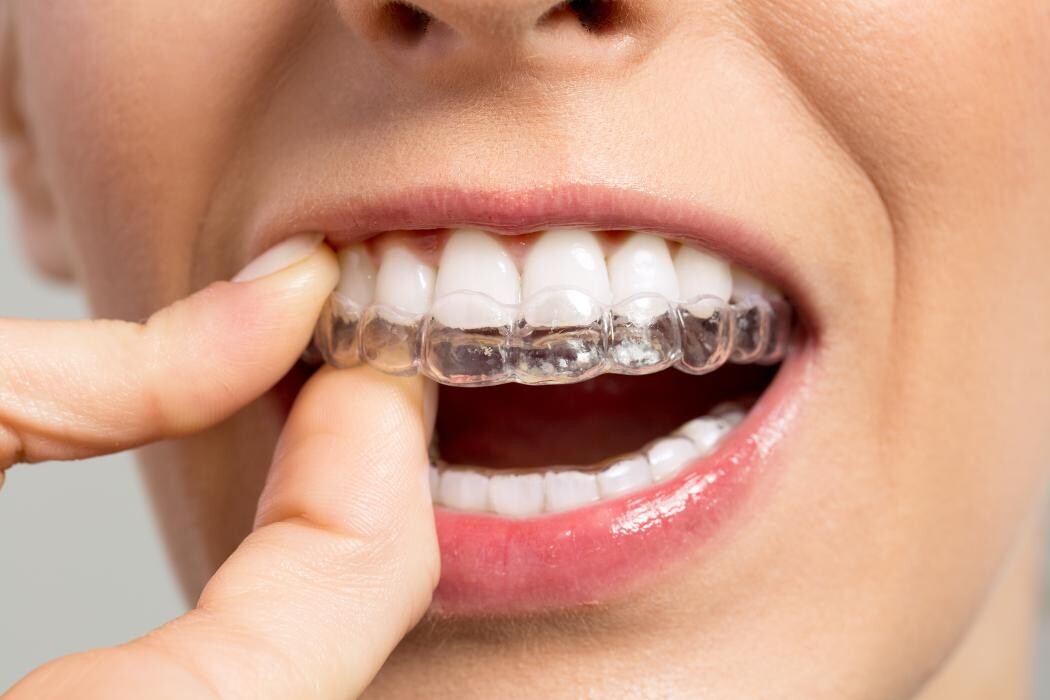 Images Downey Dental Solutions