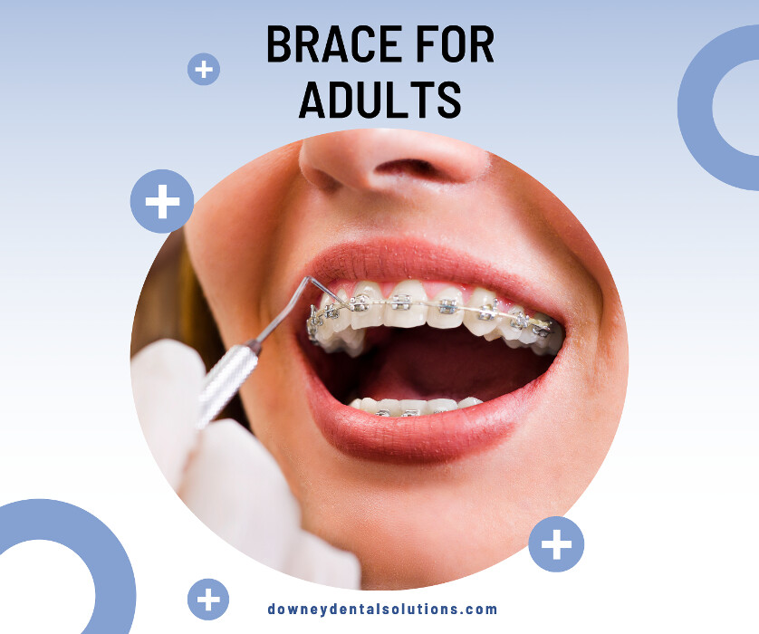 Images Downey Dental Solutions