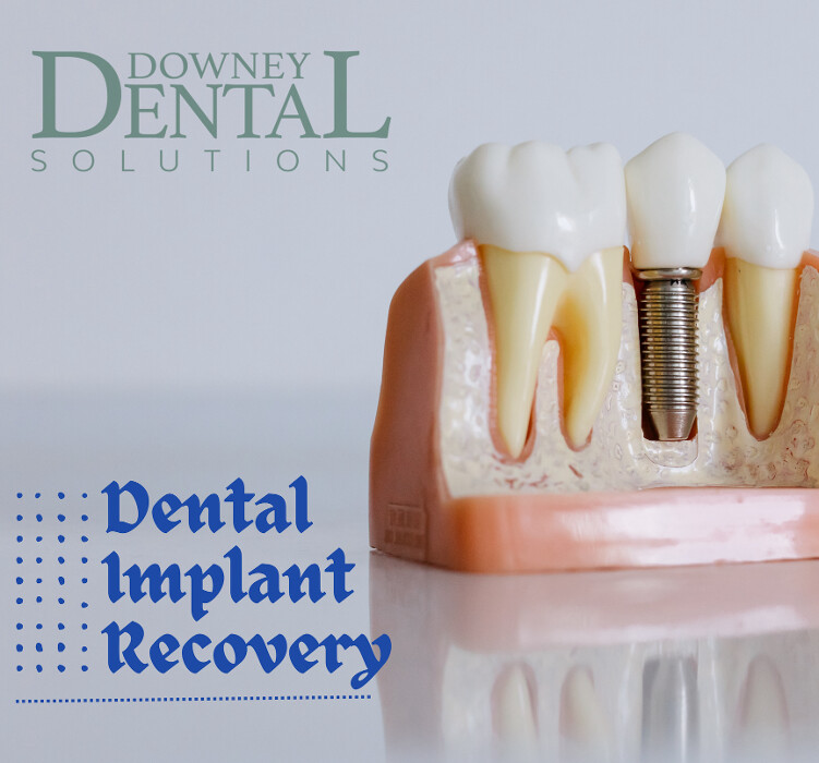 Images Downey Dental Solutions