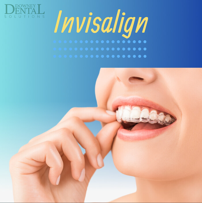 Images Downey Dental Solutions