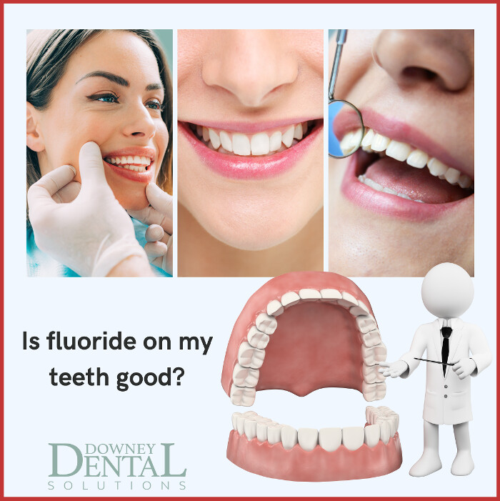 Images Downey Dental Solutions