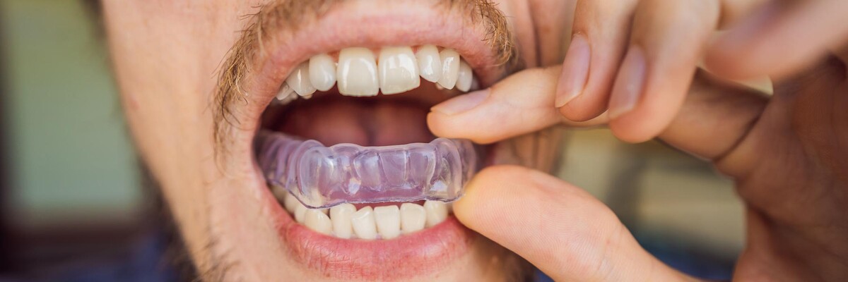 Images Downey Dental Solutions
