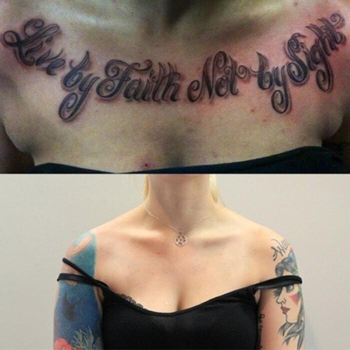 Images Removery Tattoo Removal & Fading