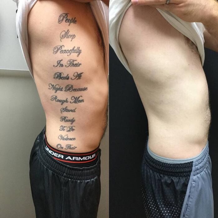 Images Removery Tattoo Removal & Fading