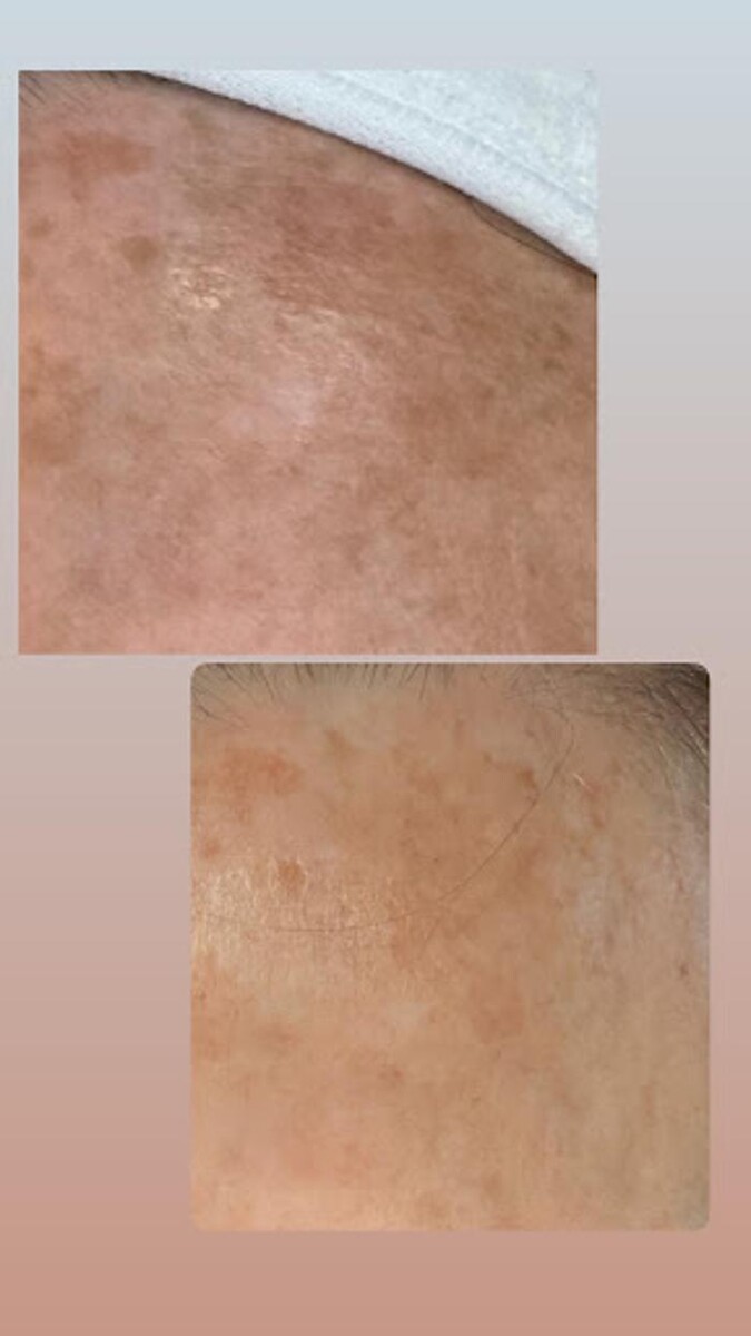 Images InSkin Solutions