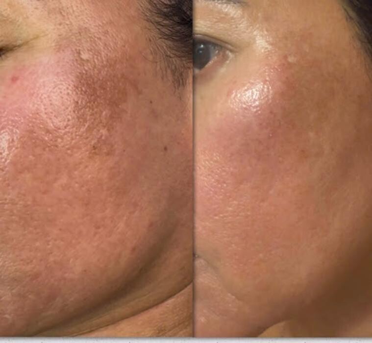 Images InSkin Solutions