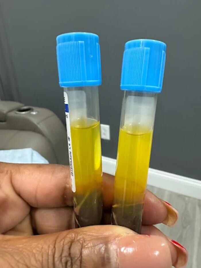 Images BouncebackIV Medspa